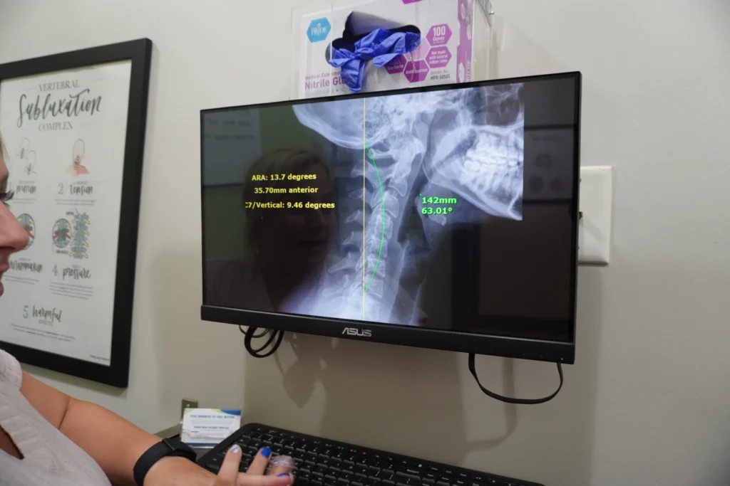 IBD & the Nervous System: What People in South Jersey Should Know About Their Symptoms 4 Inflammatory bowel disease treatment in South Jersey